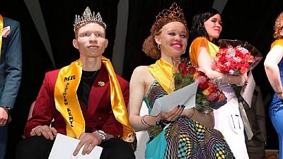 Concours Mr et Miss Albinos au Kenya: «La beauté par-delà la couleur»