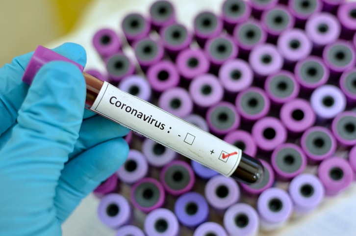 Coronavirus - Relever le défi de la transmission communautaire