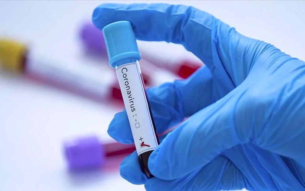 Coronavirus: 169 nouveaux cas, 5 décès supplémentaires et 28 cas graves 