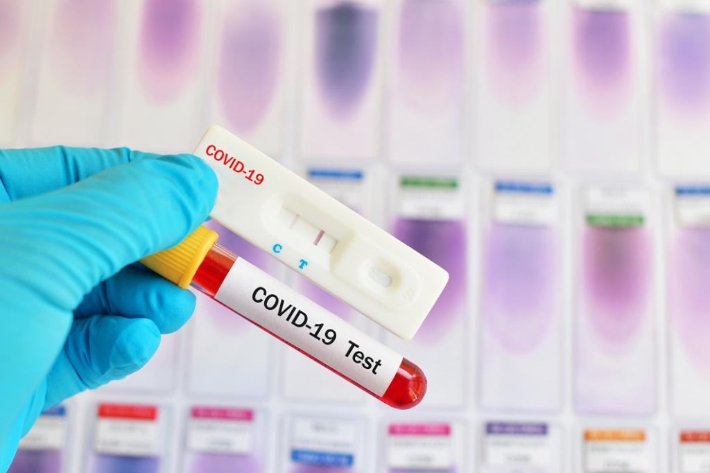 Lutte contre la covid-19 : Vers la production de tests rapides de diagnostic à Dakar