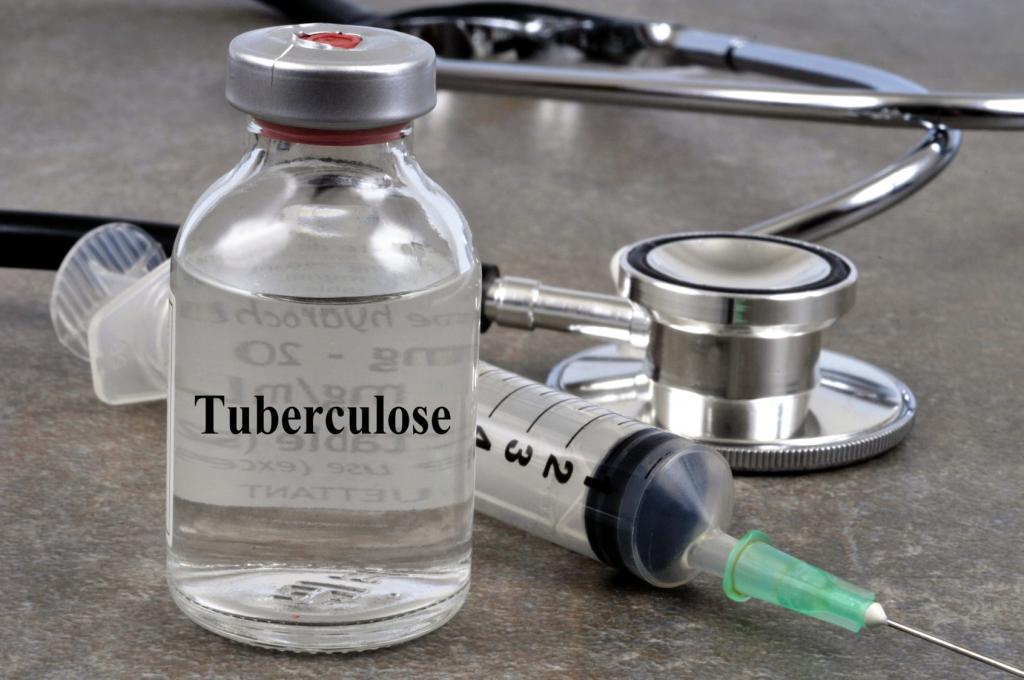 Tuberculose : des interventions menées pour la détection des cas manquants